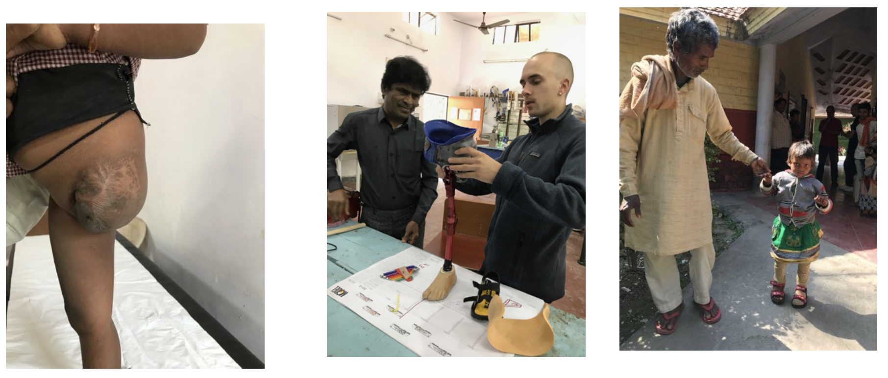 Orthopedics Deployment in Varanasi